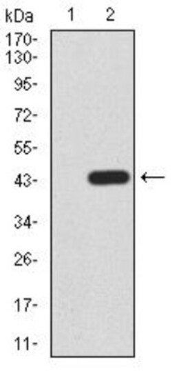 LRP-1 Antibody (1F6C6) - BSA Free, Novus Biologicals 0.025 mg | Buy Online | Novus Biologicals | Fisher Scientific